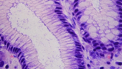 Ein bedeutender Fortschritt zur Vorbeugung gegen Magenkrebs. TUM erforscht neuen Wirkstoff. (Foto: Raquel Mejías Luque / TUM)